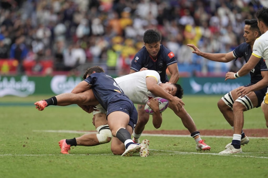Hong Kong Sevens players are generally pretty good in protecting against dental trauma, according to the tournament’s dentist. Photo: Elson Li