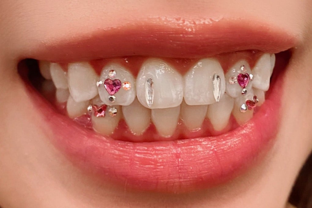 Tooth gems are seen on the teeth of a client of Miu Lam Pui-shan, a Hong Kong tooth gem artist who attributes the city’s love of the flashy dental accessories to celebrities such as Hailey Bieber and Blackpink’s Lisa. Photo: The Sparkle