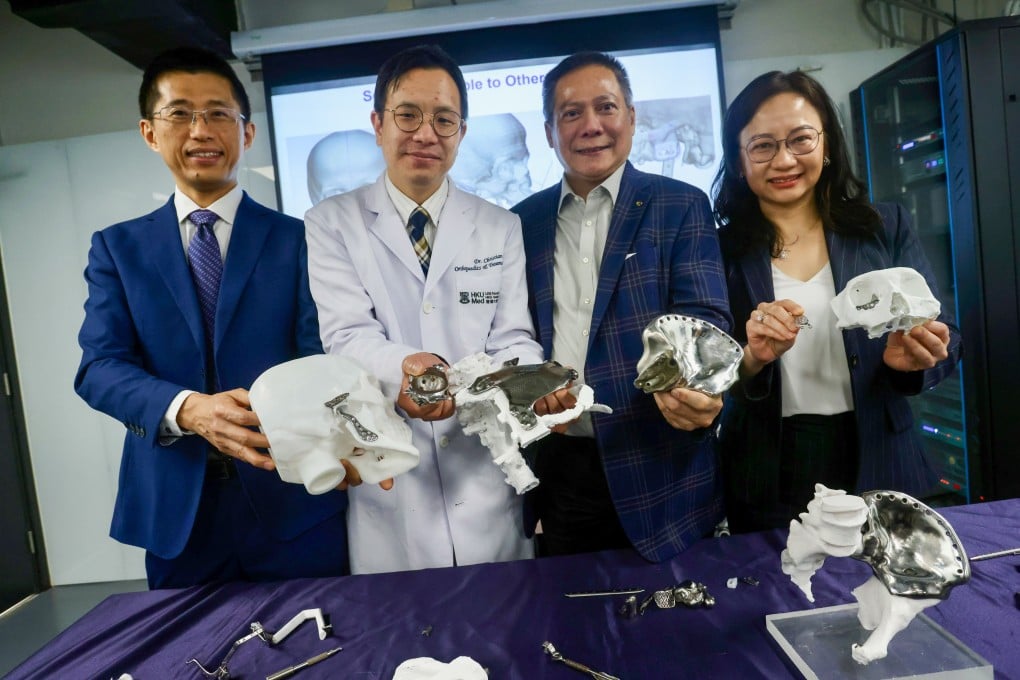 (From left) HKU professor of dentistry Richard Su, associate professor of orthopaedics Christian Fang, Koln 3D CEO Edmond Yau and consultant Yip Pui-pui, showing some of the medical technology firm’s products. Photo: Jonathan Wong