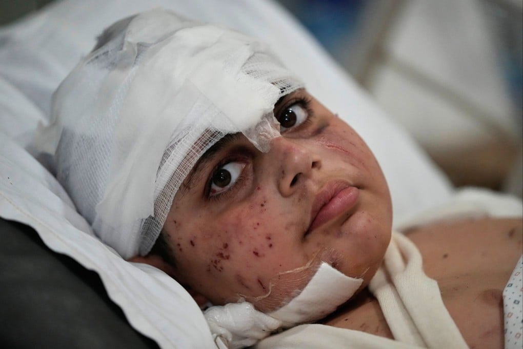 Ali Salman, 12, who was injured in an Israeli strike, lies on a bed at Jabal Amel hospital in the southern port city of Tyre, Lebanon. Photo: AP