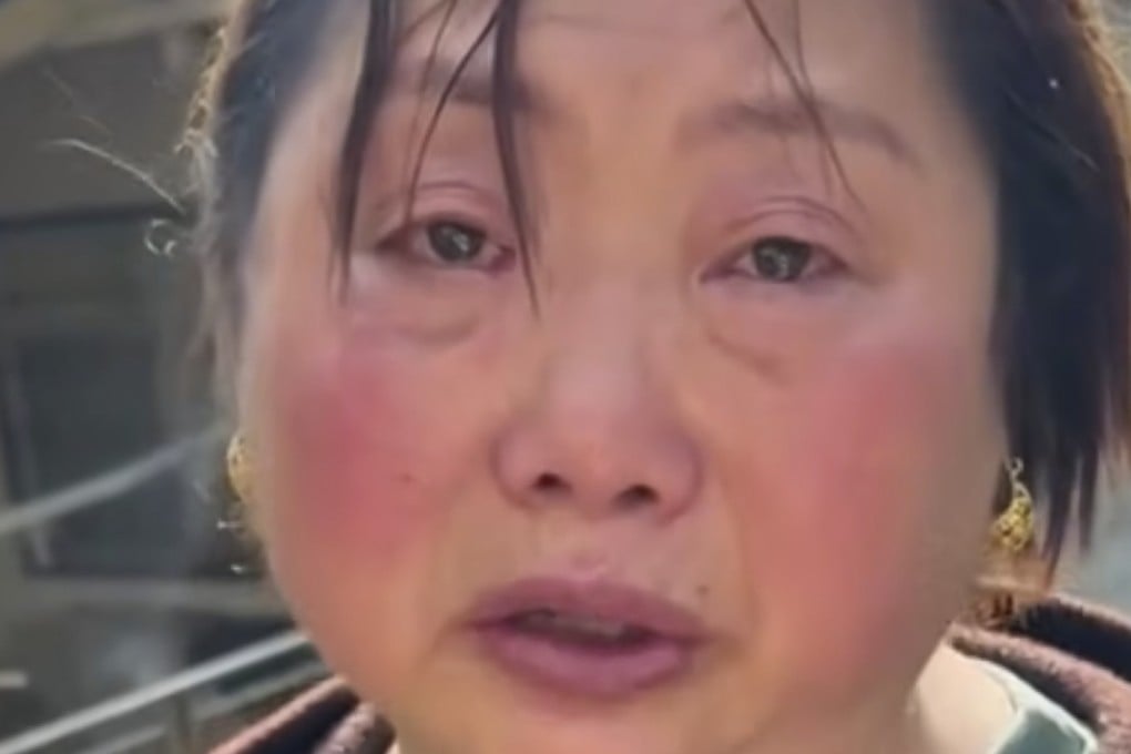 A female official in a rain-hit Chinese county has faced a backlash for wearing gold earrings while crying about the disaster. Photo: Sohu