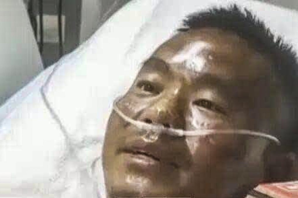 A Chinese man remarkably survived a grueling seven-day ordeal at sea. He suffered severe hallucinations and sustained himself by eating raw crabs. Photo: Handout