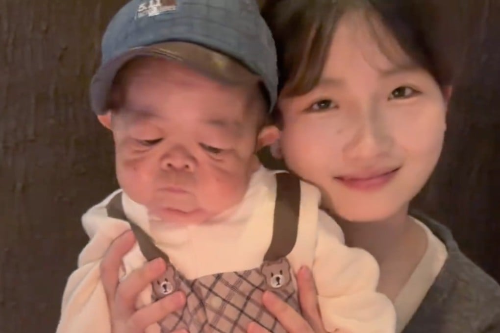 A 25-year-old Chinese man, who has remained the size of a baby, has gone viral after his 21-year-old sister shared her experiences caring for him. Photo: Handout