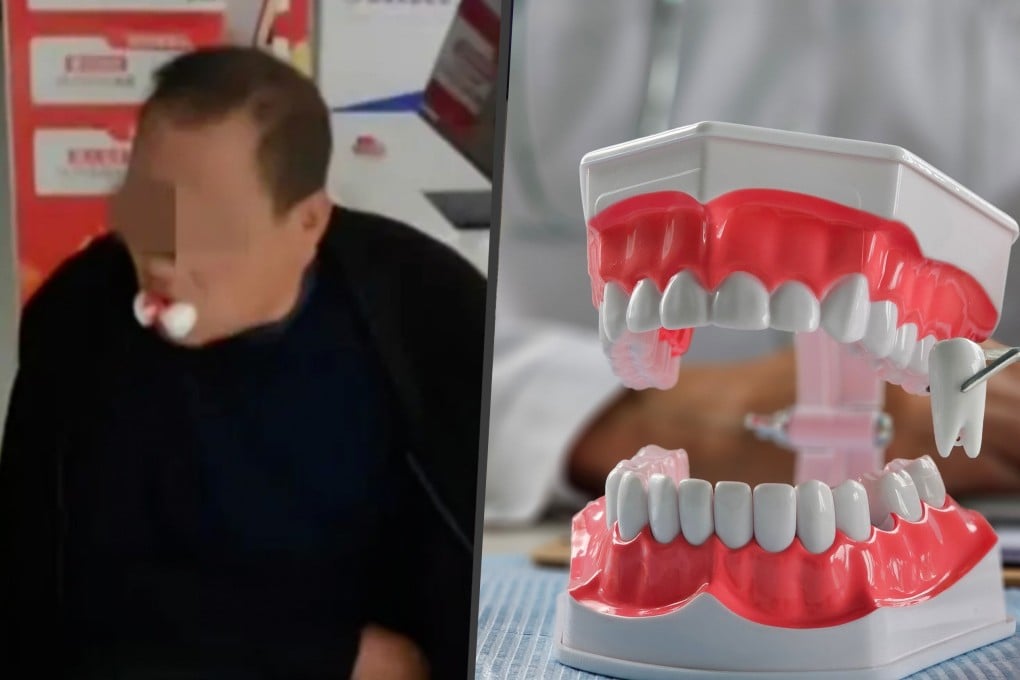 A Chinese clinic extracted 12 teeth from a 63-year-old man who had complained of just a single toothache, completely ignoring his pre-existing high blood pressure. Photo: SCMP composite/The Paper/Shutterstock