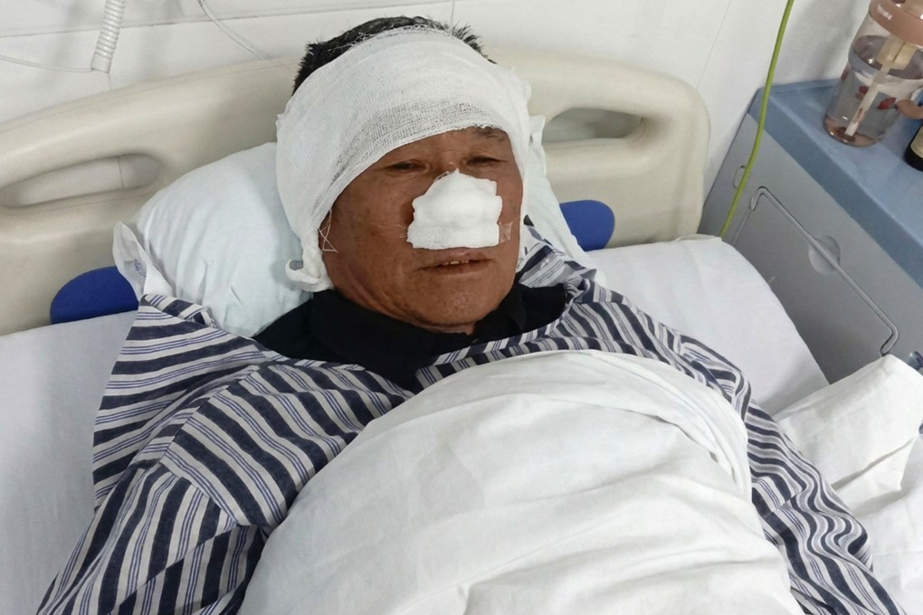 A 69-year-old Chinese hero had his nose bitten off while shielding a woman from a violent attacker and holding the suspect down for police. Photo: QQ.com