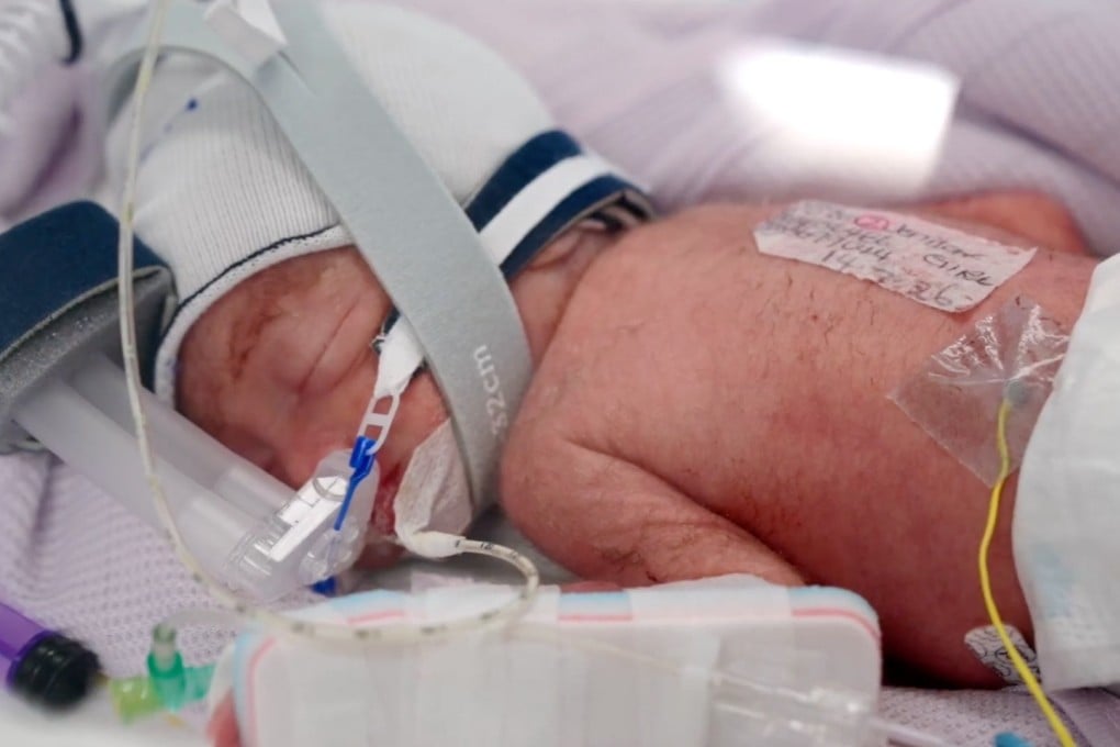 One of the quadruplets in an incubator in Brisbane, Australia. Photo: Metro North Health via AP