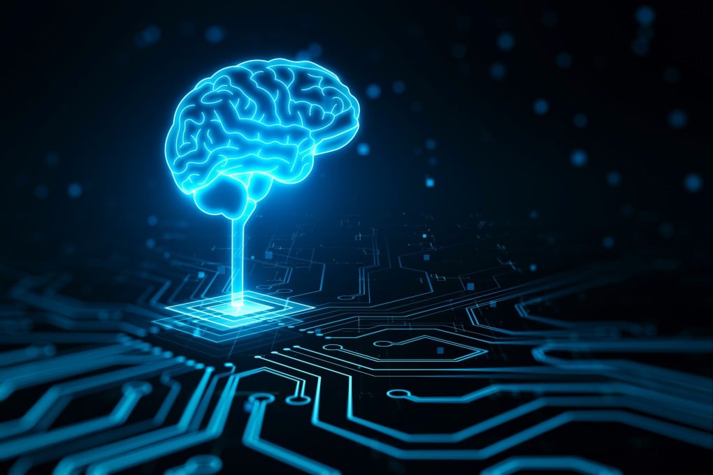 Chinese start-ups are developing brain-computer interfaces that can be implanted via a vein in just 10 minutes. Photo: Shutterstock