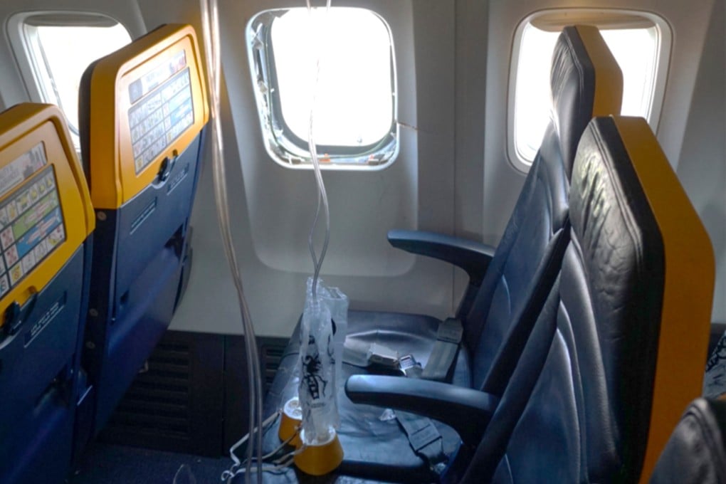 An undated image shows the window on a Ryanair plane that was broken by a stray engine part shortly after take-off, causing a man’s head to be sucked into the hole. Photo: National Transportation Safety Board via AP