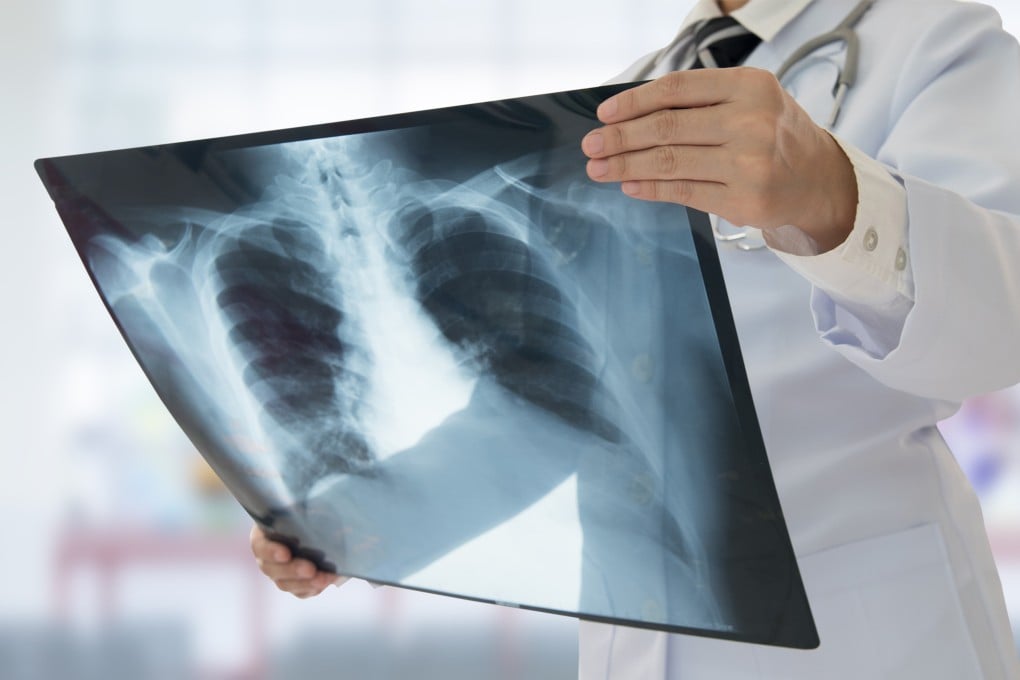 China’s tabletop X-ray ghost imaging method could be used to capture dynamic objects such as rotating aircraft engines or biological movements like a beating heart. Photo: Shutterstock