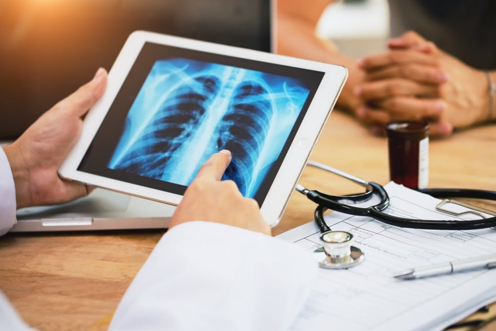Advances in treating lung cancer – the most common and deadliest type in the city – such as targeted therapy and immunotherapy had improved global survival rates. Photo: Getty Images