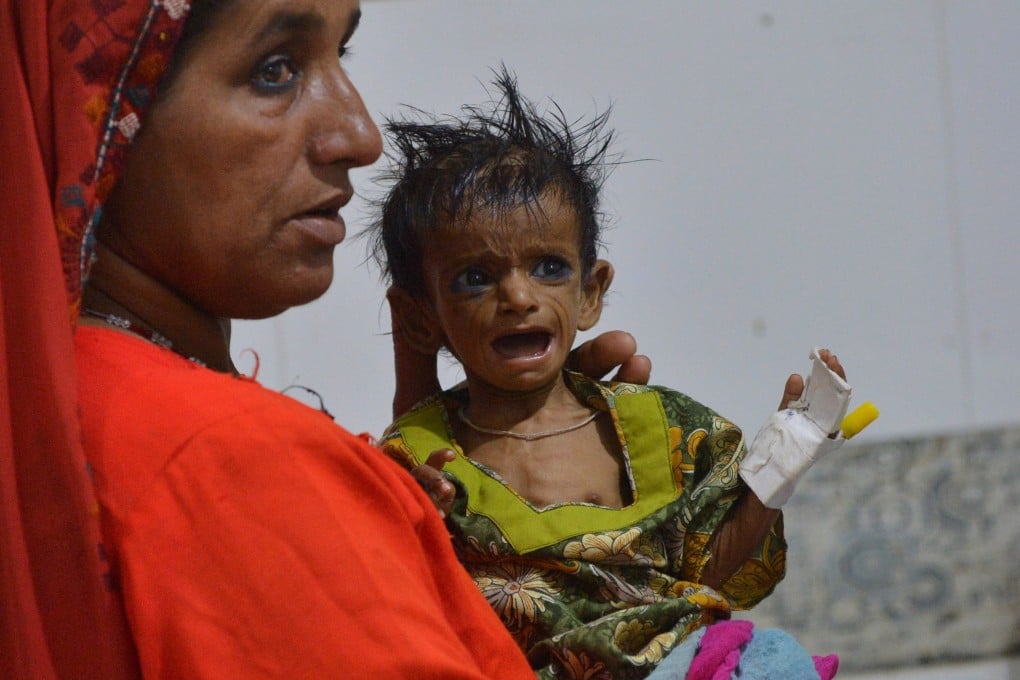 A woman holds her baby at Mithi Civil Hospital in southern Pakistan. Photo: AFP