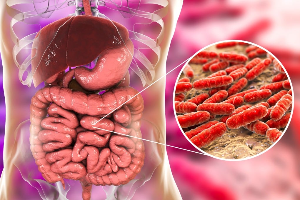 The gut bacteria that make up the human microbiome play a role in all sorts of diseases. Image: Shutterstock