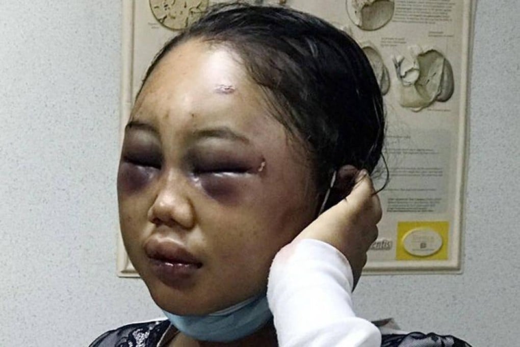 Suyanti Sutrinso. Photo: The Straits Times