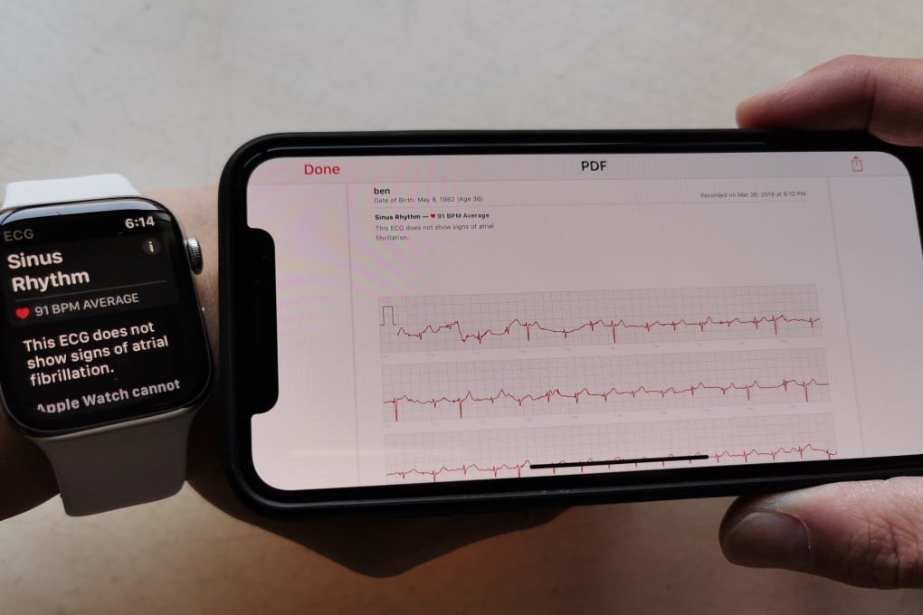 Abnormal ecg apple watch clearance