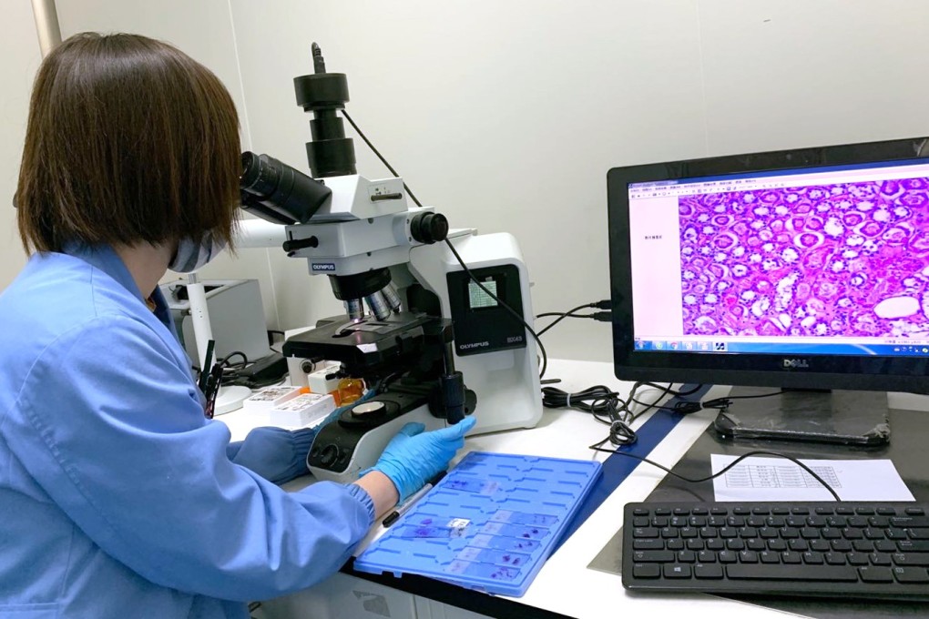 Liver cancer is generally difficult to detect in its early stages. Photo: Handout