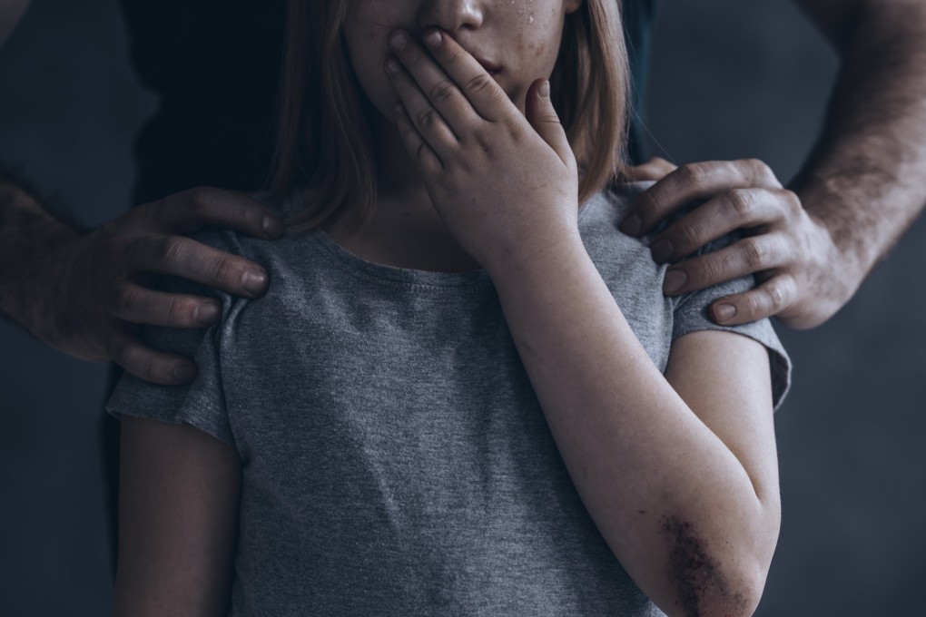 In the past five years, the number of reported sexual abuse cases involving a child victim ranged from 456 to 506 each year, according to police figures. Photo: Shutterstock