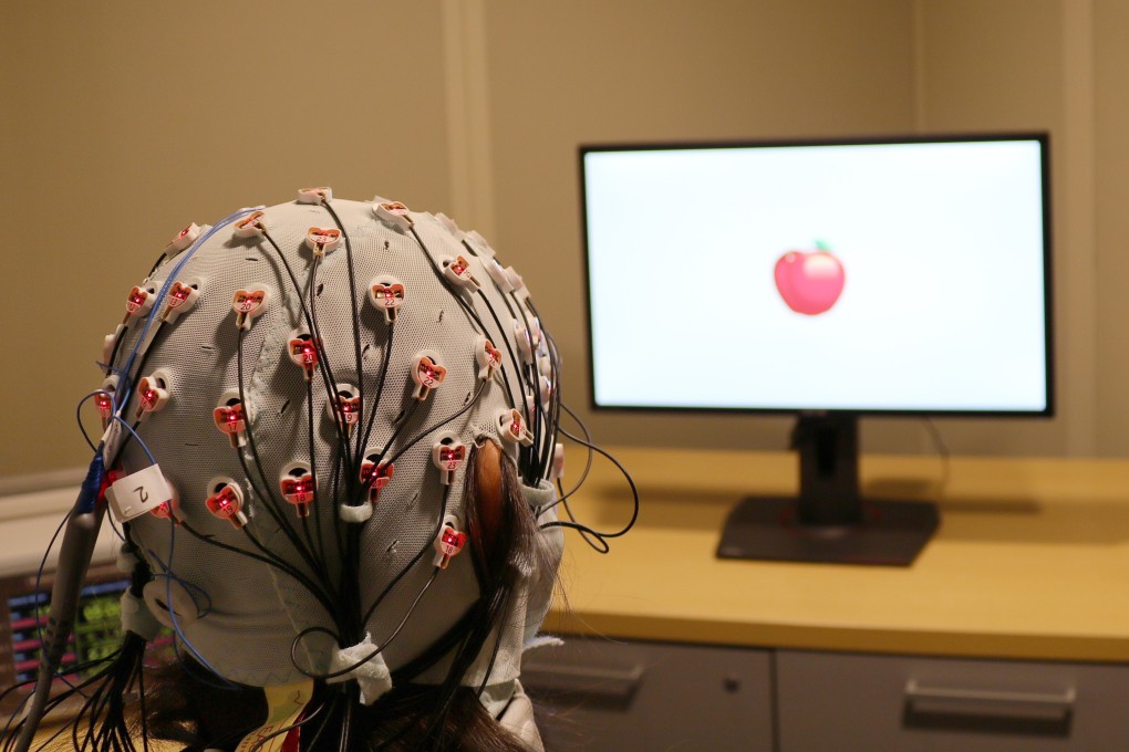 A cap that administers electrical stimulation and monitors brain waves for a visual working memory test at a Boston University lab. Photo: AP