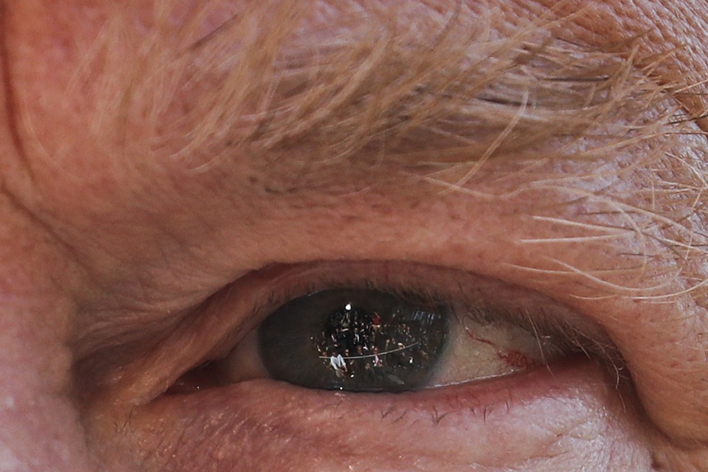 Members of the media are seen reflected in the eye of President Donald Trump as he answers questions on the South Lawn of the White House, on April 10. Despite Trump’s gaffes, his popularity ratings have continued to hold steady. Photo: AP