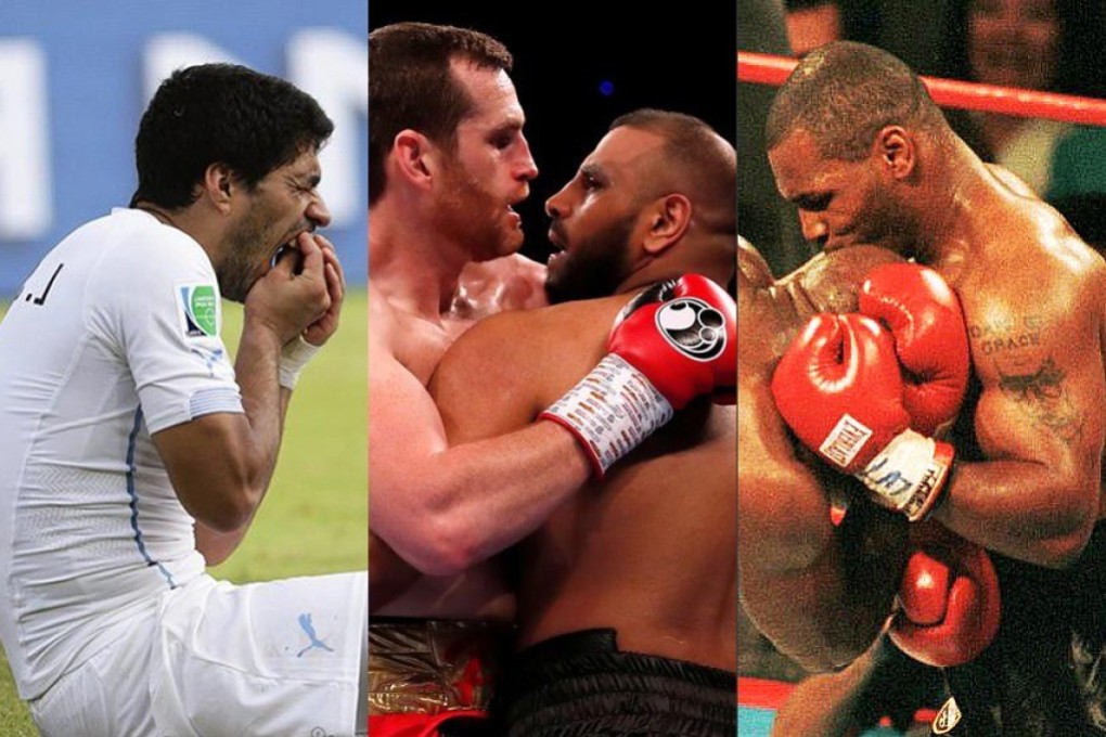 Luis Suarez, Kash Ali and Mike Tyson have all bitten their opponents. Photo: EPA, Reuters, Action Images