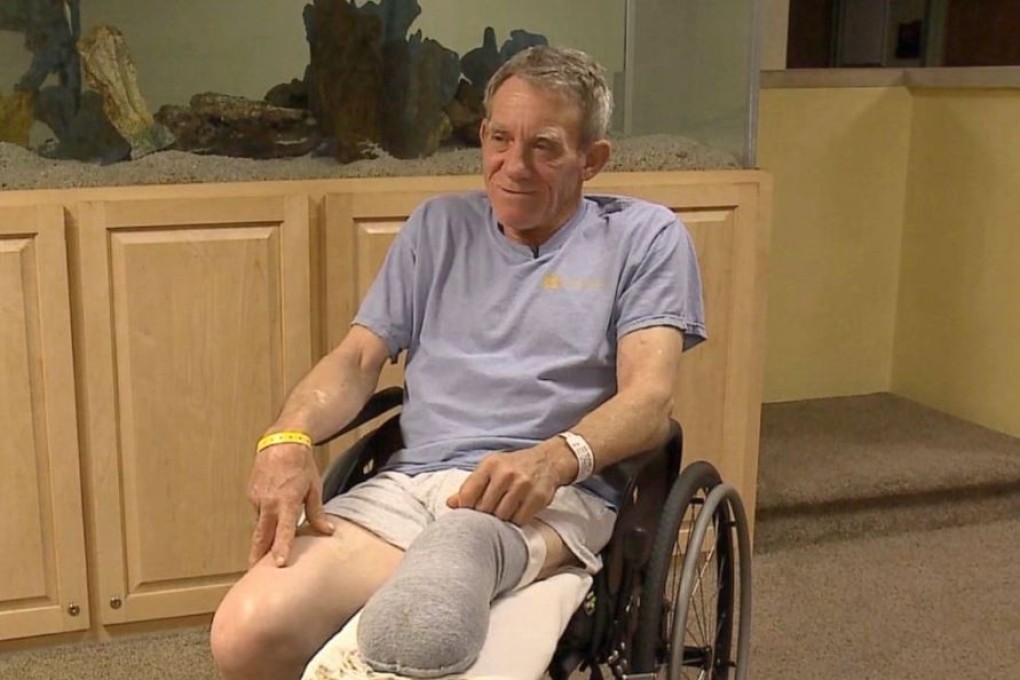 Kurt Kaser, a US farmer in his 60s whose leg was horrifically sucked into a corn hopper sawed off the limb with a pocket knife to save his life.