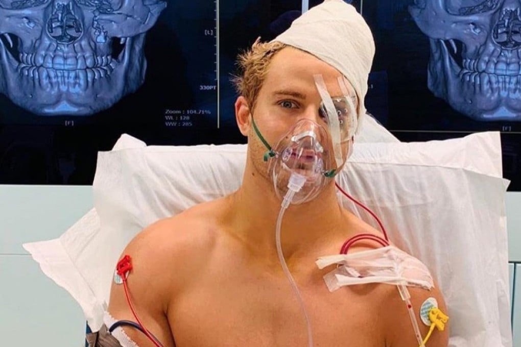 Sage Northcutt reveals his facial injuries suffered at last Friday’s One Championship in Singapore. Photo: Instagram
