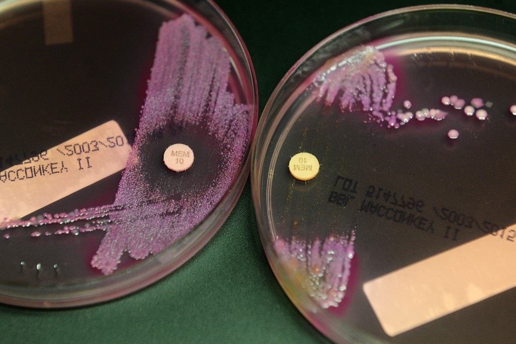 A bacterial sample at left contains carbapenem-resistant Enterobacteriaceae, able to grow despite the presence of an antibiotic. Photo: Los Angeles Times/TNS