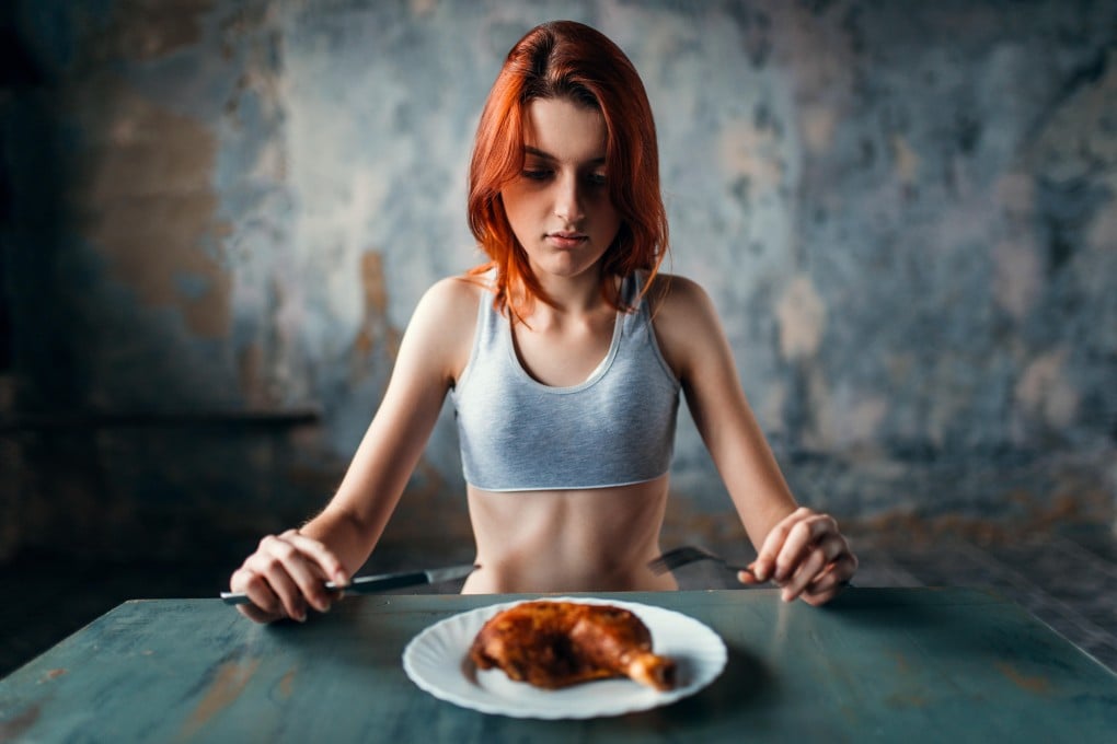 Eating disorders are not about weight, nor body image or food. Anorexia just presents that way in symptoms. Anorexia is a complex mental health disorder driven by a web of components. Photo: Alamy