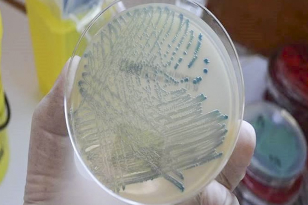 There were 972 cases of carbapenemase-producing enterobacteriaceae (CPE) detected in Hong Kong in 2018. Photo: Hospital Authority