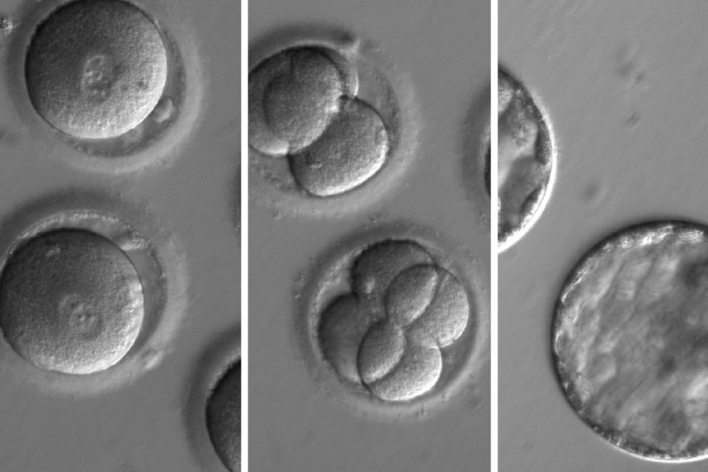 A breakthrough by Chinese scientists in gene-editing technology has raised the prospect of approved human clinical trials in just one or two years’ time. Photo: Handout