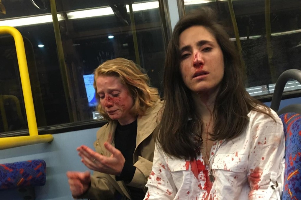 The two women were beaten in a homophobic attack on a London bus. Photo: Facebook