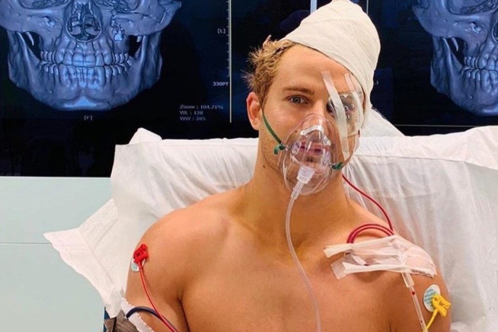 Sage Northcutt is recovering from a nine-hour operation on eight facial fractures after his One Championship debut ended in a 29-second KO loss. Photo: Instagram