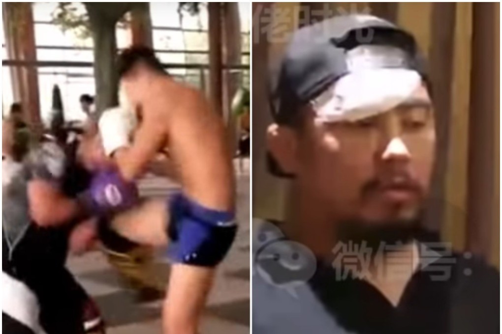 Xu Xiaodong takes a knee to the face during a ‘sparring’ session (left). His head was bandaged up when he spoke about it afterwards. Photos: YouTube/Fight Commentary Breakdowns
