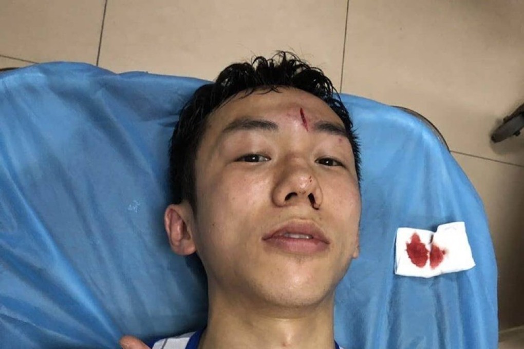 Rex Tso gives the thumbs up after requiring eight stitches for a head wound suffered during a Shanghai amateur bout. Photo: Rex Tso/Facebook