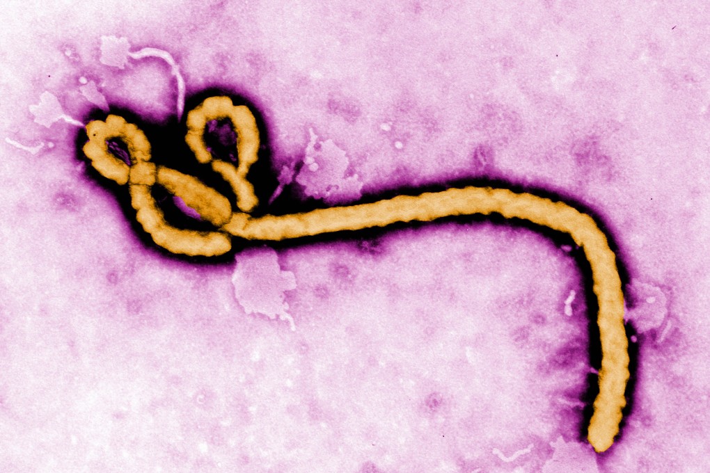 An Ebola virus as seen under a microscope. Photo: Handout