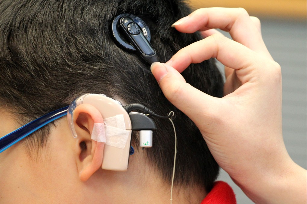 The Education Bureau provides hearing aids and fitting services for children with hearing difficulties. The service is free of charge for three years. Photo: Felix Wong