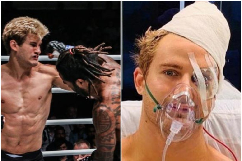Sage Northcutt takes a punch from Cosmo Alexandre (left). He needed an nine-hour operation afterwards. Photos: One Championship/Instagram