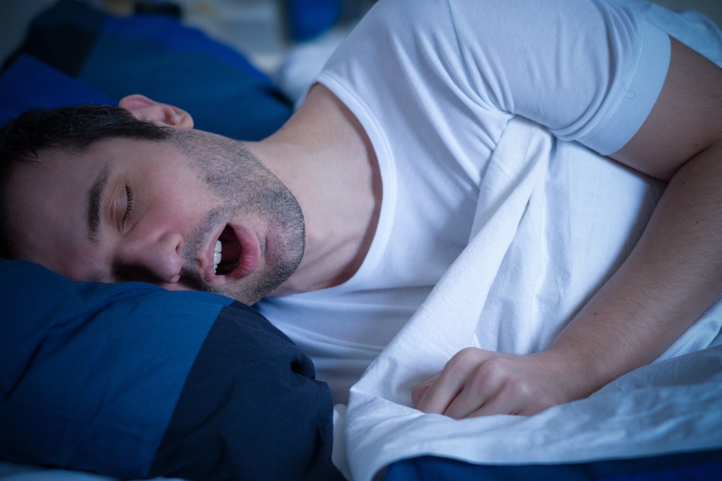 One of the main symptoms of obstructive sleep apnoea is loud snoring. Photo: Shutterstock.