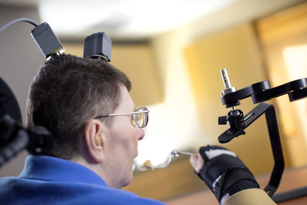 Bill Kochevar, 56, is using computer-brain interface technology and an electrical stimulation system to move his own arm after eight years of paralysis, in this undated handout. Photo: Handout