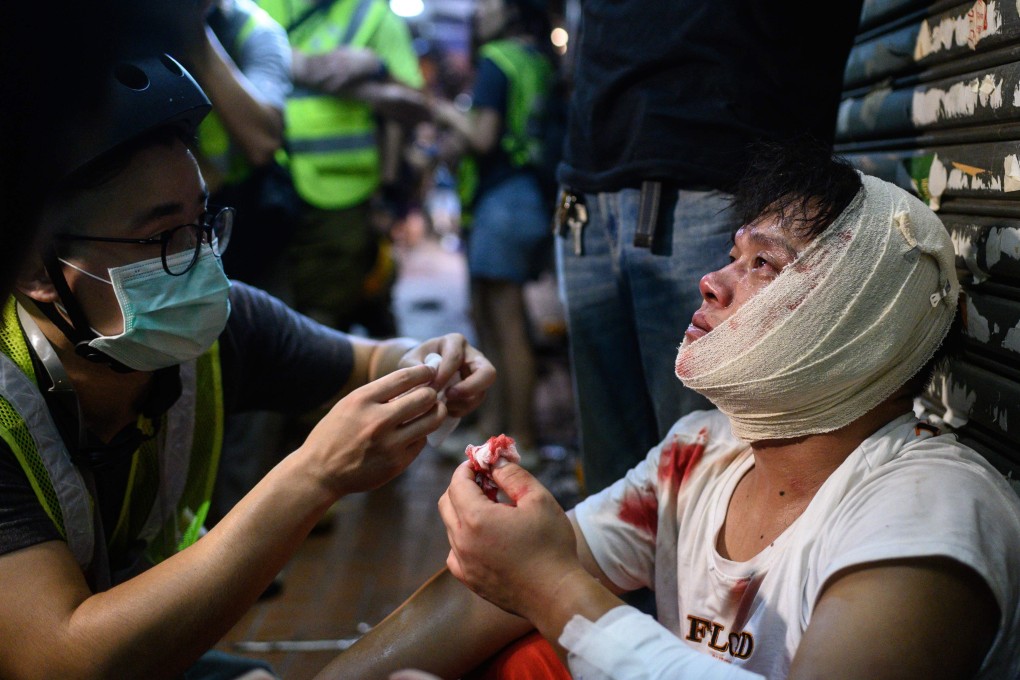 An injured man is attended to as he sits on the street after a clash during a protest in Tsuen Wan on August 5. Photo: AFP