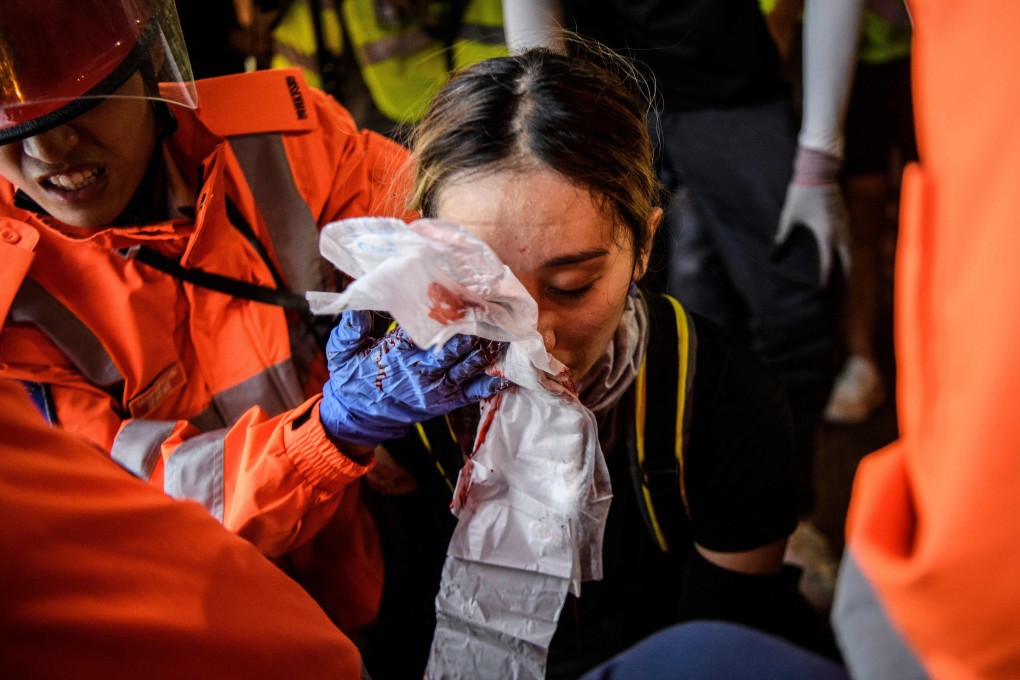 Doctors look after a woman who received a facial injury in Tsim Sha Tsui on August 11. Photo: AFP