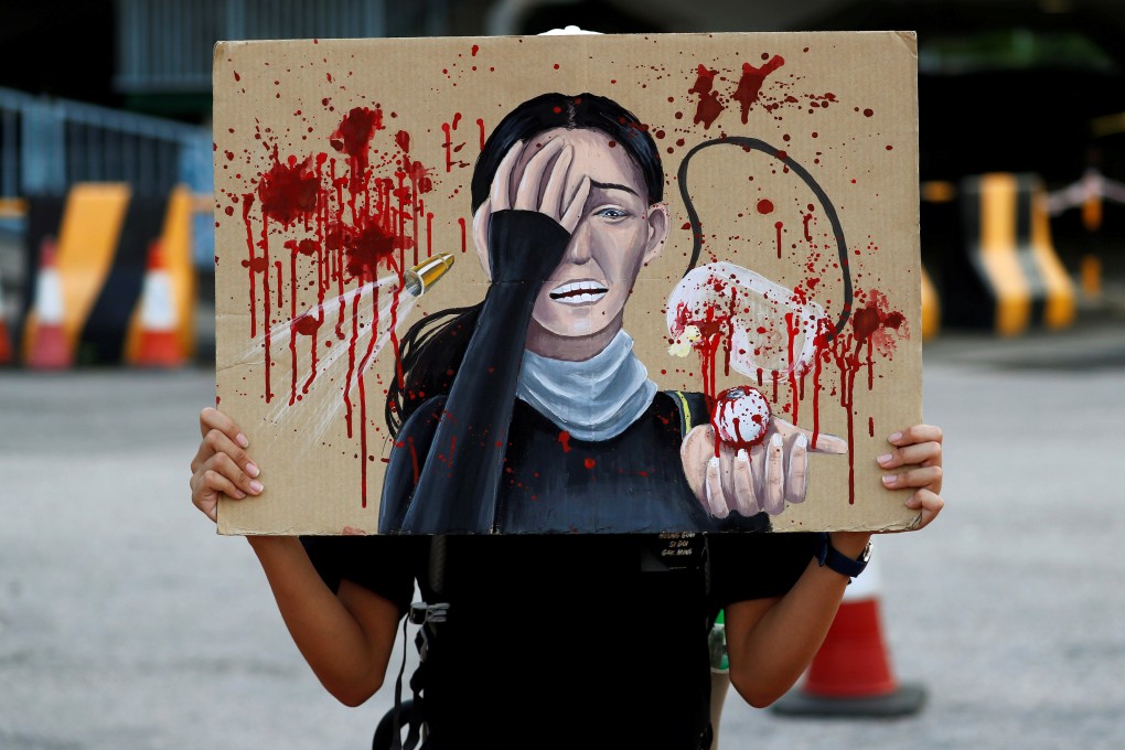 A student holds up a placard honouring a woman who was shot in the eye at a protest, during a rally calling on the government to meet the protesters’ five demands outside City Hall in Central on August 22. Photo: Reuters