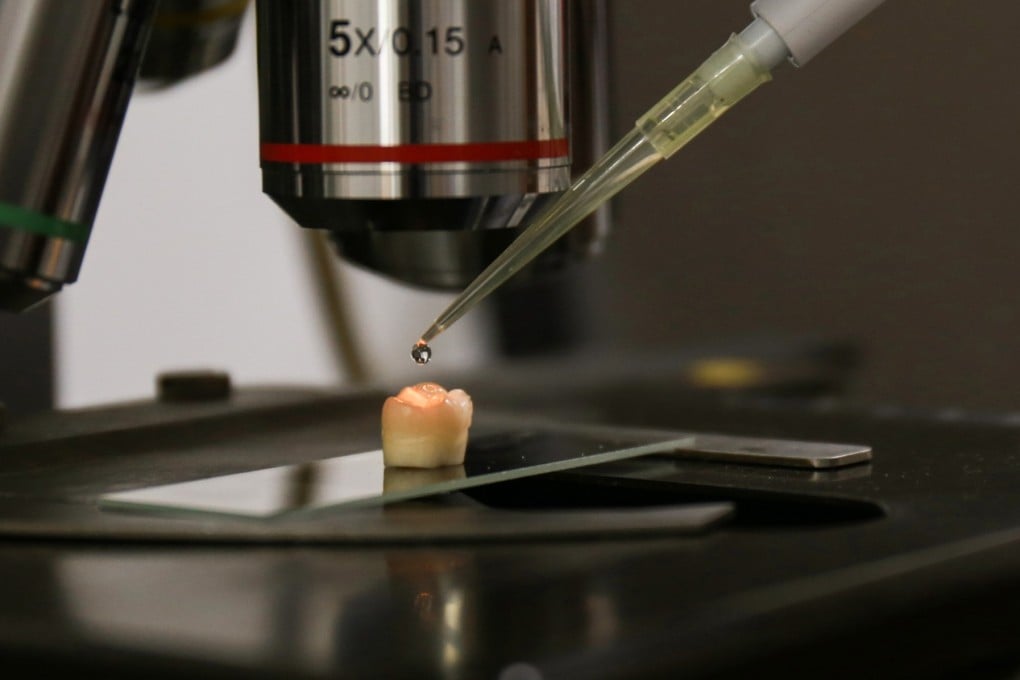 Drops of the liquid solution are applied to a human tooth. Photo: Zhejiang University