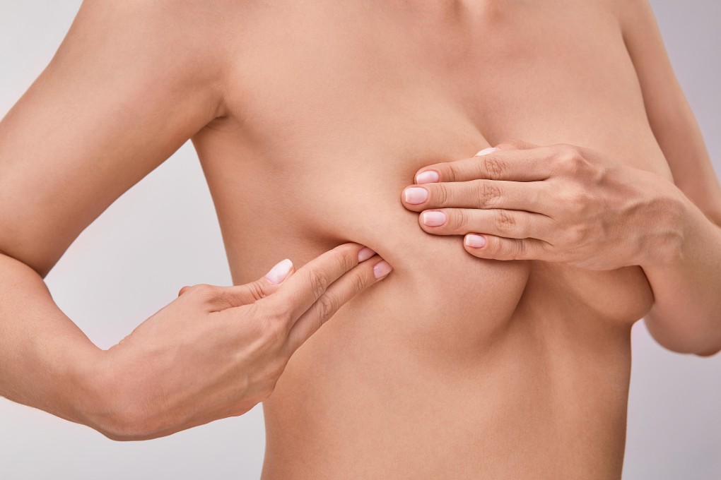 Self-administered breast exams, as well as undergoing routine mammograms at a doctor’s office, have been proven to save lives. Photo: Alamy