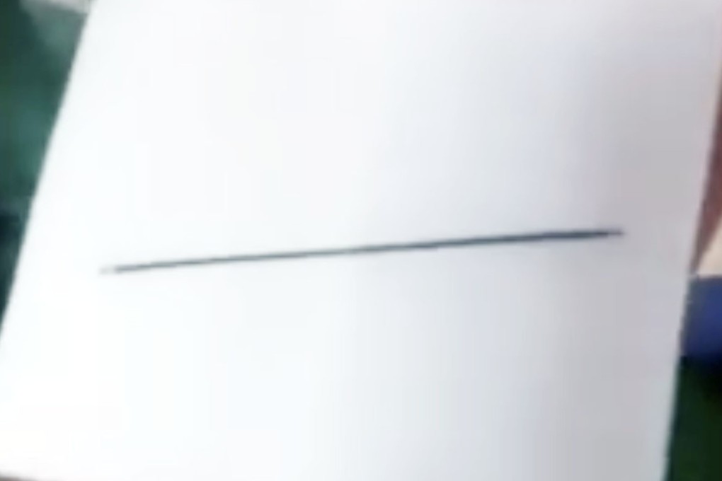 The needle found inside the heart of an 11-year-old girl in China. Photo: Weibo