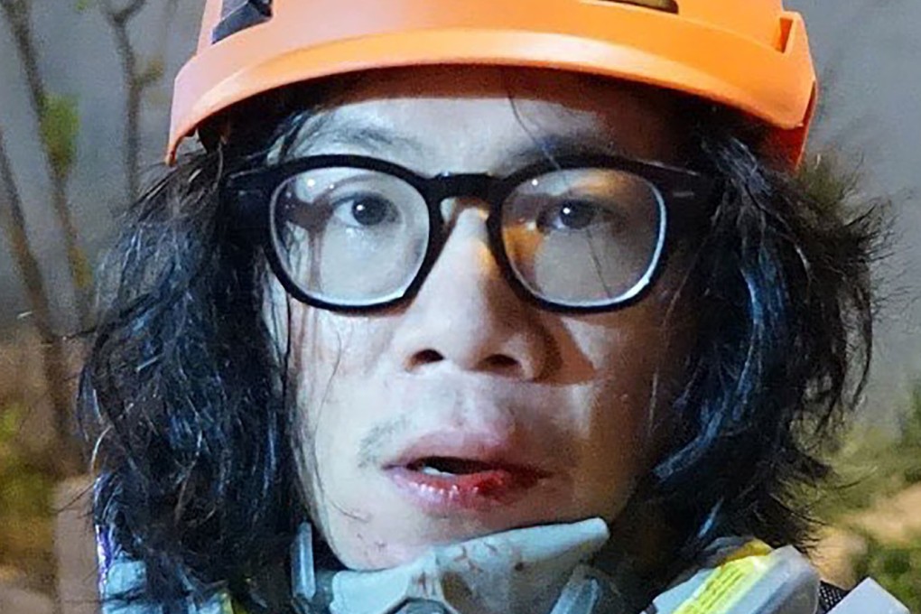The Stand News reporter suffered wounds to his lips as he was punched in the face and hit to the ground while covering police’s mob dispersal operation in Yau Ma Tei on Friday. Photo: Handout