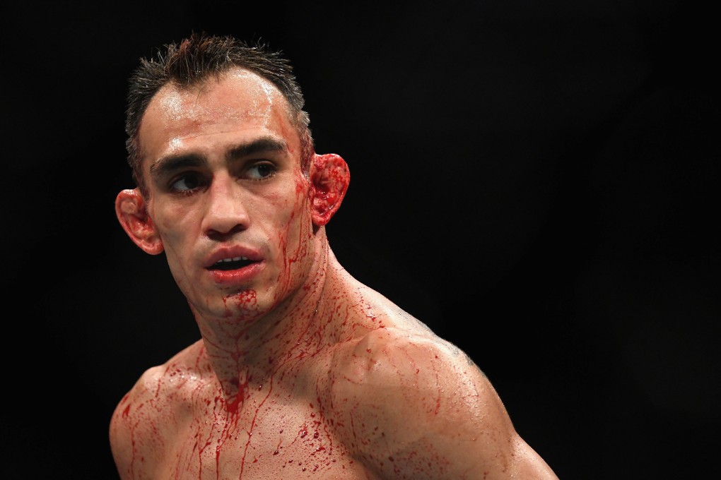 Tony Ferguson looks on while competing against Anthony Pettis. Photo: AFP