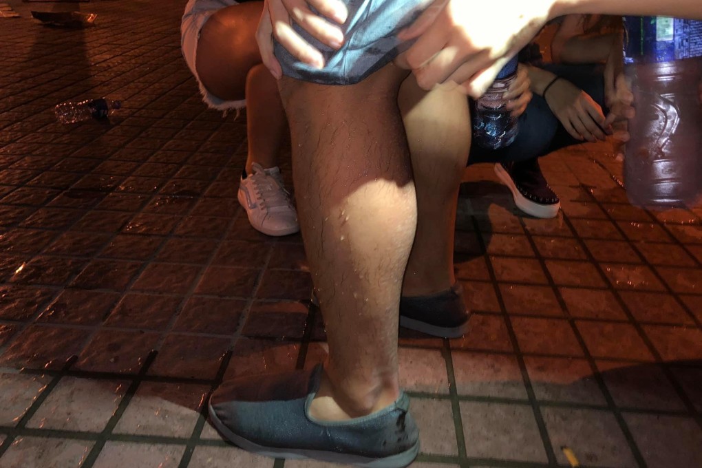 Other passers-by helped those hit by the chemical by rinsing their wounds with water. Photo: Facebook