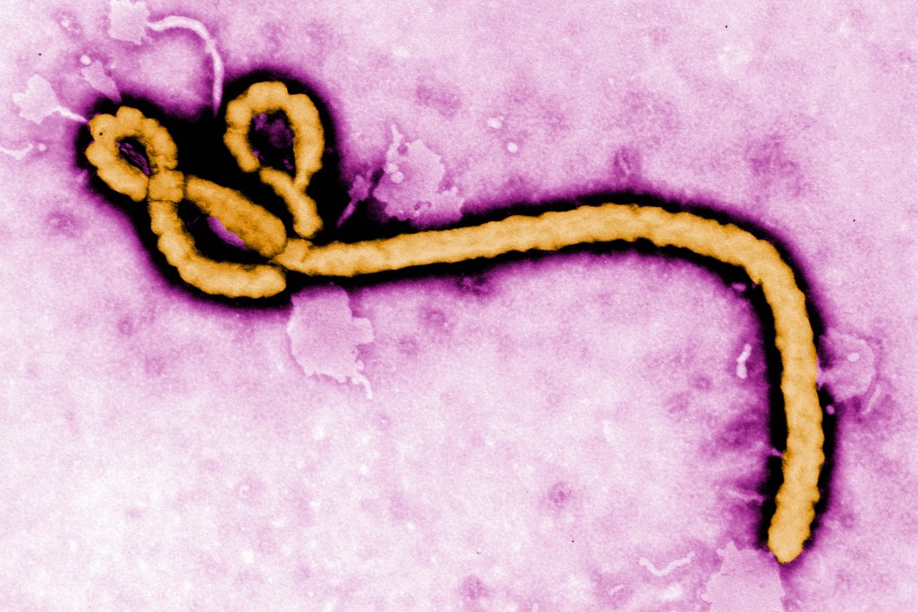 The Ebola virus as seen under an electron microscope. Photo: Handout