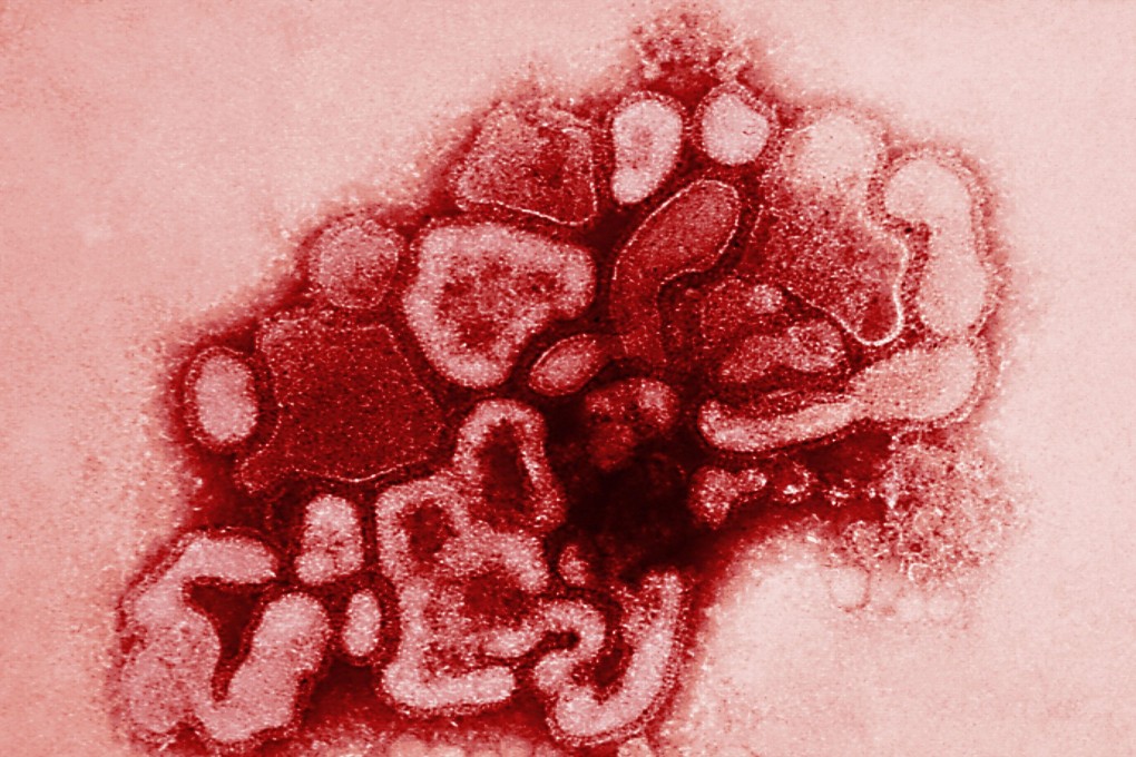 If a global pandemic equivalent to the 1918 influenza pandemic – commonly known as the ‘Spanish flu’ – occurred today, it would cost around US$3 trillion. Photo: AFP