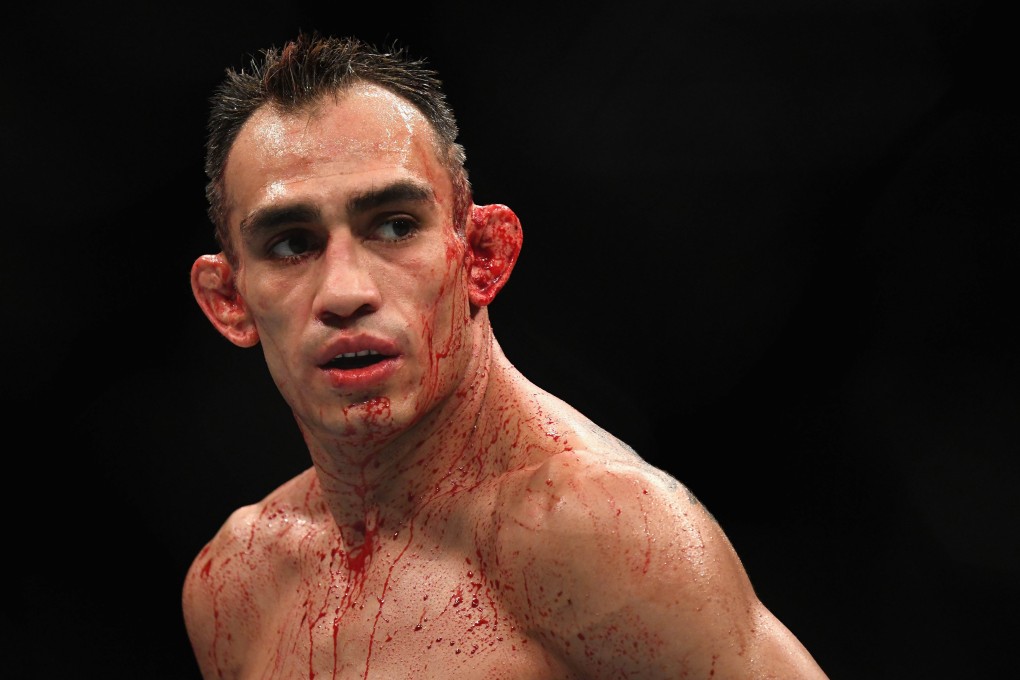 Tony Ferguson looks on while competing against Anthony Pettis in their lightweight bout at UFC 229. Photo: AFP